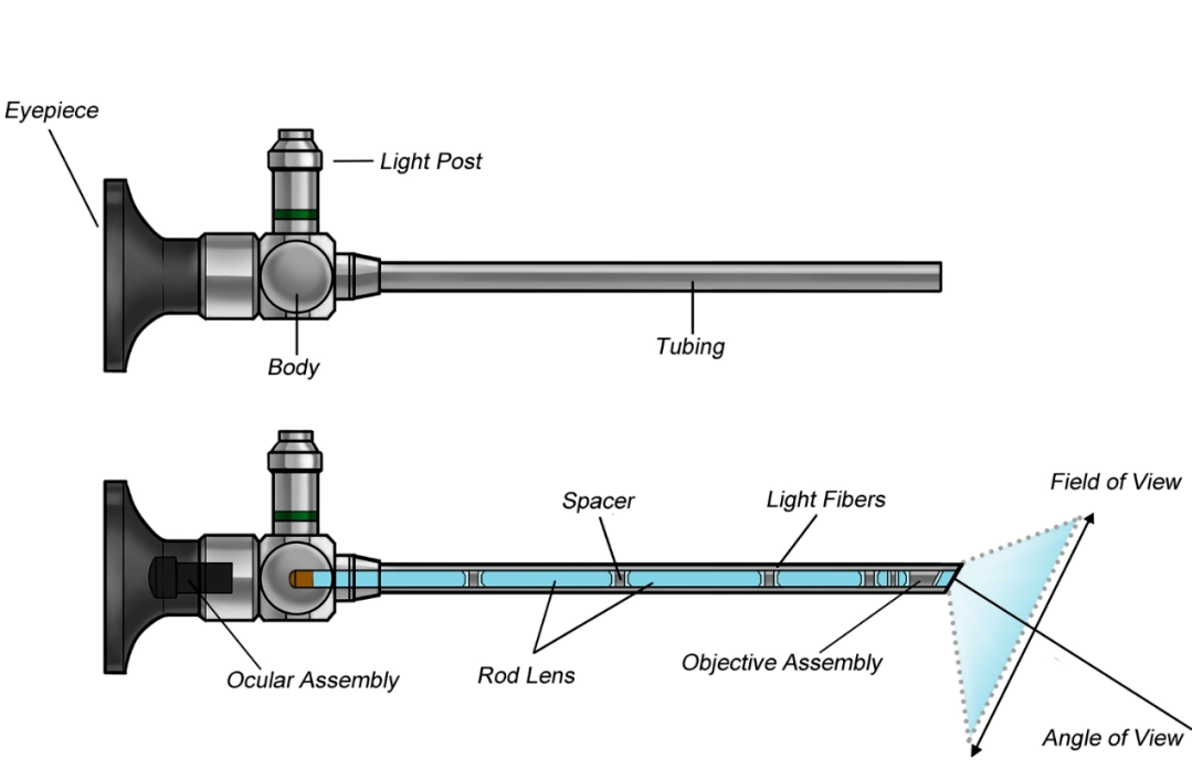 Internal_structure_diagram_of_endoscope_catheter_insertion.webp